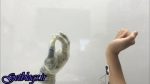 استفاده ساده تر از پروتز دست با فناوری تازه